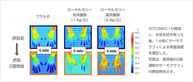 体の一部の耐えがたい“冷え” 